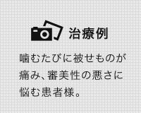 審美治療の症例