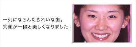 周囲の歯色に合わせてつくった歯を取り付けて完成です。