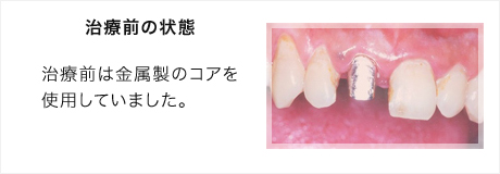 治療前