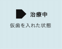 審美治療の症例