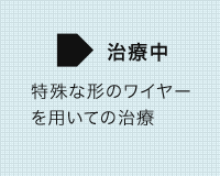 審美治療の症例