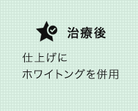 審美治療の症例