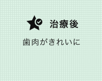 審美治療の症例