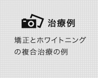 ホワイトニングの症例