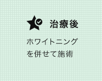 ホワイトニングの症例