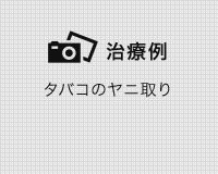 審美治療の症例