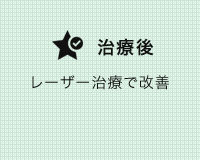 審美治療の症例