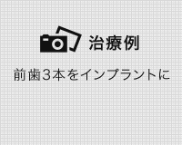 矯正治療の症例