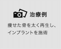 矯正治療の症例