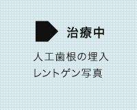 矯正治療の症例