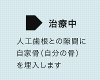 矯正治療の症例