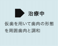 矯正治療の症例
