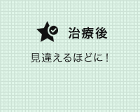 矯正治療の症例