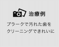 クリーニング例