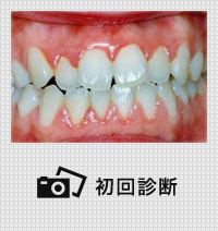初診