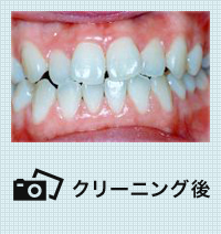 クリーニング後